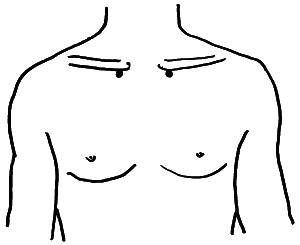 Точечный массаж для снижения веса и избавления от целлюлита. Иллюстрация № 8
