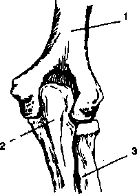 Болезни суставов. Иллюстрация № 2